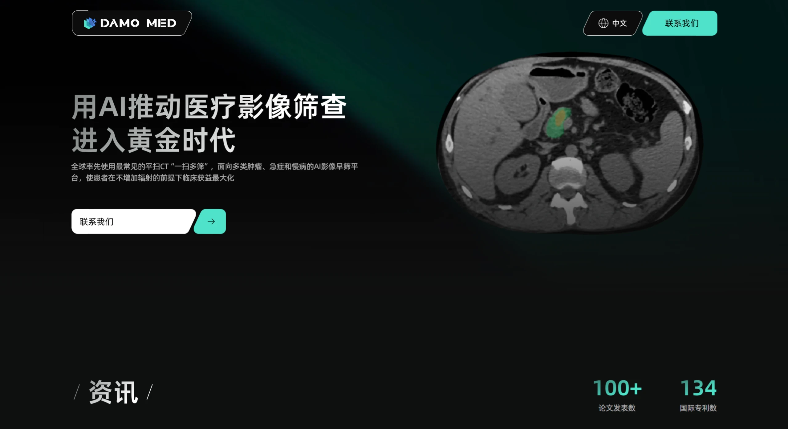 达医智影(图1) 达医智影:阿里巴巴达摩院医疗AI实验室自研的智能读片产品.webp